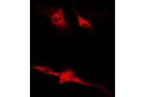 ABIN6267379 staining Hela by IF/ICC.