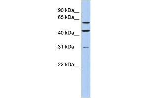 WB Suggested Anti-ZNF179 Antibody Titration:  0. (RNF112 anticorps  (Middle Region))