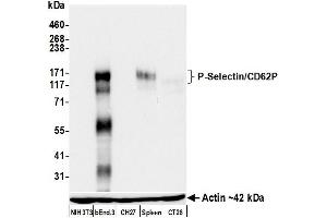 Western Blotting (WB) image for anti-Selectin P (Granule Membrane Protein 140kDa, Antigen CD62) (SELP) (AA 42-709) antibody (ABIN7795666)