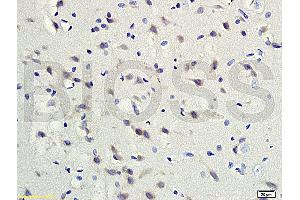 Formalin-fixed and paraffin embedded rat brain tissue labeled with Rabbit Anti-gremlin Polyclonal Antibody (ABIN687082) at 1:200 followed by conjugation to the secondary antibody and DAB staining. (GREM1 anticorps  (AA 101-184))