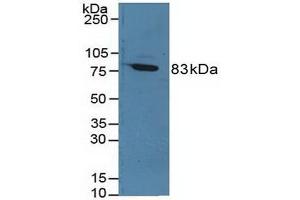 Detection of F13A1 in Rat Serum using Polyclonal Antibody to Coagulation Factor XIII A1 Polypeptide (F13A1) (F13A1 anticorps  (AA 140-377))