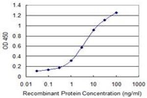 anti-Death-Associated Protein Kinase 2 (DAPK2) (AA 281-370) antibody
