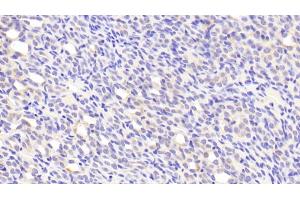 Detection of PEDF in Mouse Kidney Tissue using Polyclonal Antibody to Pigment Epithelium Derived Factor (PEDF)