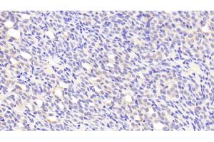 Detection of PEDF in Mouse Kidney Tissue using Polyclonal Antibody to Pigment Epithelium Derived Factor (PEDF) (PEDF anticorps  (AA 19-417))