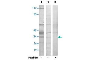 Western blot analysis of extracts from HepG2 cells (Lane 1 and lane 3) and COLO 205 cells (Lane 2), using HNRNPC polyclonal antibody . (HNRNPC anticorps)