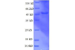 Actin Related Protein 2/3 Complex, Subunit 3, 21kDa (ARPC3) (AA 2-175), (partial) protein (GST tag)