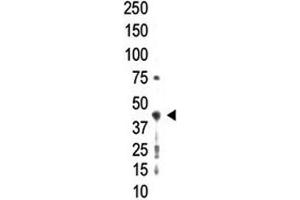 Western blot analysis of PRMT2 antibody and whole HL-60 cell lysate