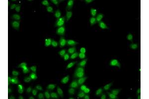 Immunofluorescence analysis of A549 cells using HDGFRP2 antibody (ABIN5975300).