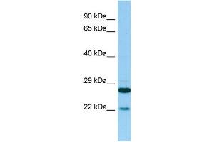 WB Suggested Anti-PTGES2 Antibody Titration: 1. (PTGES2 anticorps  (N-Term))