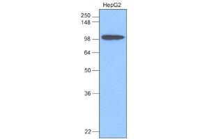 Western Blotting (WB) image for anti-Hexokinase 1 (HK1) antibody (ABIN361062) (Hexokinase 1 anticorps)