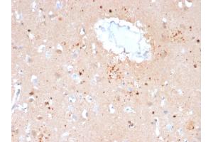 Formalin-fixed, paraffin-embedded human Brain stained with Ubiquitin Mouse Monoclonal Antibody (UBB/2122).