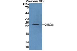 Western blot analysis of the recombinant protein. (PTPRA anticorps  (AA 618-796))