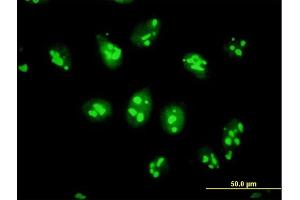 Immunofluorescence of purified MaxPab antibody to PES1 on HeLa cell. (PES1 anticorps  (AA 1-588))
