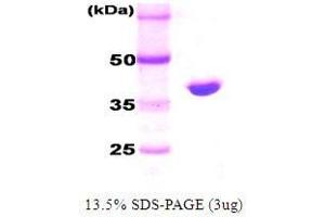 Figure annotation denotes ug of protein loaded and % gel used. (DnaK (AA 1-384), (N-Term) Protéine)