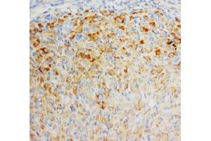 IHC-P: FGF8 antibody testing of rat ovary tissue (FGF8 anticorps  (C-Term))