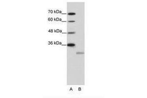 Image no. 1 for anti-Eukaryotic Translation Initiation Factor 4E Family Member 2 (EIF4E2) (N-Term) antibody (ABIN202116) (EIF4E2 anticorps  (N-Term))