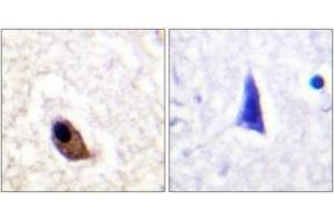 Immunohistochemistry analysis of paraffin-embedded human brain, using NMDAR2A/B (Phospho-Tyr1246/1252) Antibody.