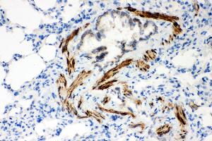 Anti- ATP2A2 antibody,IHC(P) IHC(P): Rat Lung Tissue
