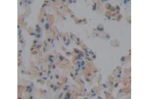 IHC-P analysis of Human Tissue, with DAB staining. (Peroxidasin anticorps  (AA 76-260))