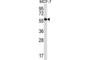 Western Blotting (WB) image for anti-Mitogen-Activated Protein Kinase Associated Protein 1 (MAPKAP1) antibody (ABIN2997754) (MAPKAP1 anticorps)