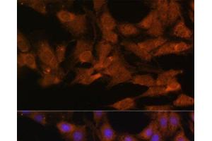Immunofluorescence analysis of C6 cells using DDX3X Polyclonal Antibody at dilution of 1:100. (DDX3X anticorps)