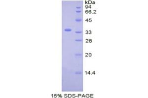 SDS-PAGE analysis of Human CDK4 Protein. (CDK4 Protéine)
