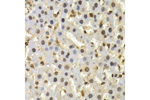 Immunohistochemistry of paraffin-embedded rat liver using CUL4B antibody (ABIN6130211, ABIN6139255, ABIN6139258 and ABIN6221048) at dilution of 1:200 (40x lens). (Cullin 4B anticorps  (AA 1-200))