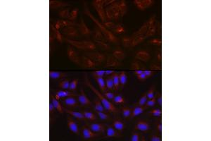 Immunofluorescence analysis of U-2 OS cells using NSF Rabbit pAb (ABIN6130571, ABIN6144871, ABIN6144872 and ABIN6214029) at dilution of 1:100 (40x lens). (NSF anticorps  (AA 1-250))