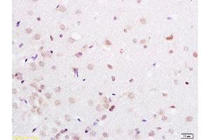 Formalin-fixed and paraffin embedded rat brain labeled with Anti-PAX3 Polyclonal Antibody, Unconjugated at 1:200 followed by conjugation to the secondary antibody and DAB staining