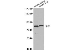 Western blot analysis of extracts of various cell lines, using IFI16 antibody.
