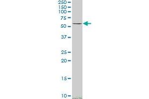 SMAD4 monoclonal antibody (M02), clone 3E2.