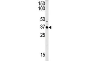 Western Blotting (WB) image for anti-SET Domain Containing 8 Pseudogene 1 (SETD8P1) antibody (ABIN2996452) (SET7 anticorps)