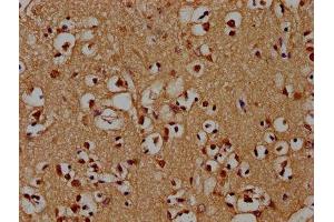 IHC image of ABIN7142212 diluted at 1:100 and staining in paraffin-embedded human brain tissue performed on a Leica BondTM system. (PSMD4/ASF anticorps  (Regulatory Subunit 4))