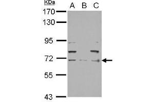 WB Image Sample (30 ug of whole cell lysate) A: PC-3 B: U87-MG C: SK-N-SH 7. (NEFL anticorps)