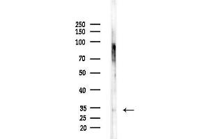 anti-ELOVL Fatty Acid Elongase 1 (ELOVL1) (Internal Region) antibody