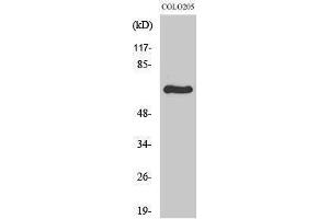 Western Blotting (WB) image for anti-Ribosomal Protein S6 Kinase, 70kDa, Polypeptide 1 (RPS6KB1) (Internal Region) antibody (ABIN3186301) (RPS6KB1 anticorps  (Internal Region))