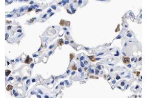 ABIN6267559 at 1/100 staining human lung tissue sections by IHC-P.