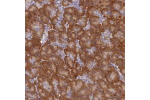Immunohistochemical staining of human pancreas with ST7L polyclonal antibody  shows moderate cytoplasmic positivity in exocrine pancreas. (ST7L anticorps)