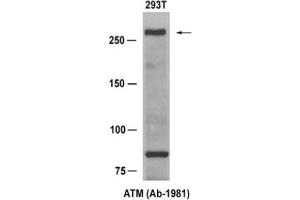 Image no. 1 for anti-Ataxia Telangiectasia Mutated (ATM) (Ser1981) antibody (ABIN319314) (ATM anticorps  (Ser1981))
