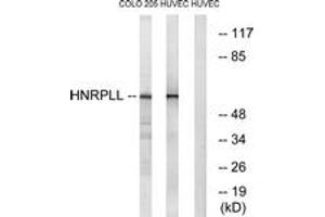 Western blot analysis of extracts from HuvEc/COLO cells, using HNRPLL Antibody. (HNRPLL anticorps  (AA 241-290))