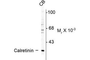 Image no. 1 for anti-Calbindin 2 (CALB2) antibody (ABIN372593) (Calretinin anticorps)