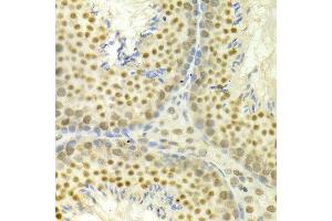 Immunohistochemistry of paraffin-embedded mouse testis using MAPK3 antibody at dilution of 1:100 (x400 lens). (ERK1 anticorps)