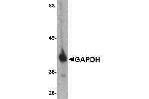 Western blot analysis of GAPDH in HeLa cell lysate with GAPDH antibody at 1 µg/mL. (GAPDH anticorps  (C-Term))