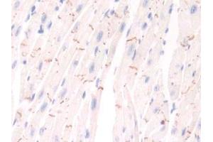 Detection of PIM1 in Mouse Cardiac Muscle Tissue using Polyclonal Antibody to Pim-1 Oncogene (PIM1)