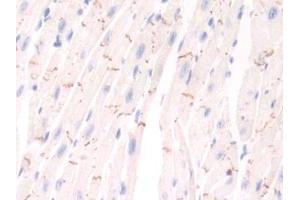 Detection of PIM1 in Mouse Cardiac Muscle Tissue using Polyclonal Antibody to Pim-1 Oncogene (PIM1) (PIM1 anticorps  (AA 122-261))