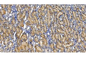 Detection of RIPK1 in Rat Kidney Tissue using Polyclonal Antibody to Receptor Interacting Serine Threonine Kinase 1 (RIPK1)