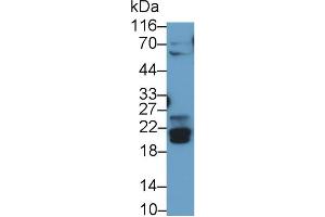 Detection of BNIP3 in Rat Skeletal muscle lysate using Polyclonal Antibody to Bcl2/Adenovirus E1B 19 kDa Interacting Protein 3 (BNIP3) (BNIP3 anticorps  (AA 3-134))