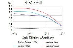 Black line: Control Antigen (100 ng),Purple line: Antigen (10 ng), Blue line: Antigen (50 ng), Red line:Antigen (100 ng)