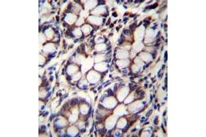 Immunohistochemistry analysis in formalin fixed and paraffin embedded human rectum tissue reacted with AP52225PU-N followed by peroxidase conjugation of the secondary antibody and DAB staining. (IQCA1 anticorps  (C-Term))