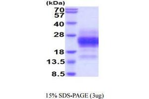 SDS-PAGE (SDS) image for Glycophorin A (GYPA) (AA 20-91) protein (His tag) (ABIN5854899)